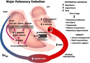 Pulmonary embolism Physiology